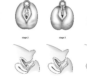 genital